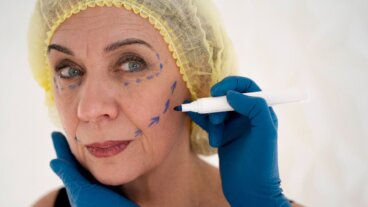 Mikä on deep plane -kasvojenkohotus?