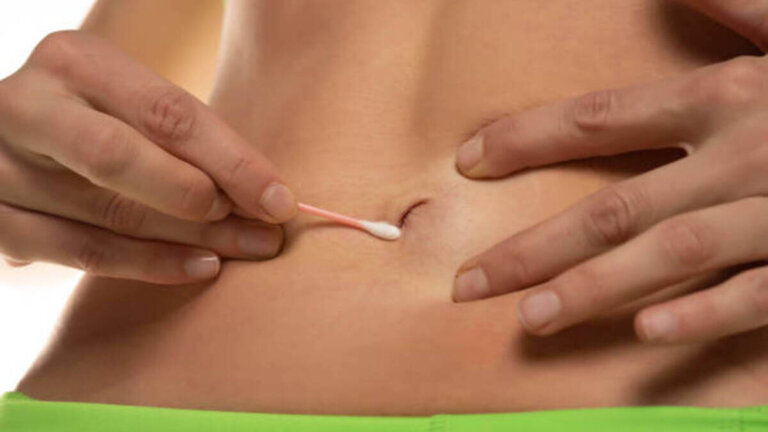 Miten napa puhdistetaan